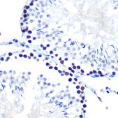 Anti-mSin3A Antibody, clone 8V5B6, Rabbit Monoclonal