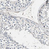 Anti-CAPN1 antibody produced in rabbit Prestige Antibodies&#174; Powered by Atlas Antibodies, affinity isolated antibody, buffered aqueous glycerol solution