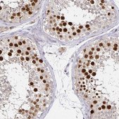 Anti-ANLN antibody produced in rabbit Prestige Antibodies&#174; Powered by Atlas Antibodies, affinity isolated antibody, buffered aqueous glycerol solution