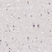 Anti-LRG1 antibody produced in rabbit Ab2, Prestige Antibodies&#174; Powered by Atlas Antibodies, affinity isolated antibody, buffered aqueous glycerol solution