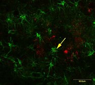Anti-Amyloid Oligomer Antibody, &#945;&#946;, oligomeric serum, Chemicon&#174;