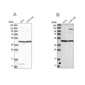 Anti-NUP43 antibody produced in rabbit Prestige Antibodies&#174; Powered by Atlas Antibodies, affinity isolated antibody, buffered aqueous glycerol solution, ab3