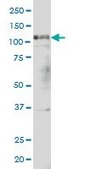 Monoclonal Anti-PTK2 antibody produced in mouse clone 1C1, purified immunoglobulin, buffered aqueous solution