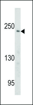 ANTI-PCM-1 (CENTER) antibody produced in rabbit purified immunoglobulin, buffered aqueous solution