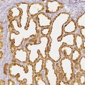 Anti-CSN1S1 antibody produced in rabbit Prestige Antibodies&#174; Powered by Atlas Antibodies, affinity isolated antibody, buffered aqueous glycerol solution