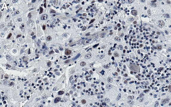 Anti-p-RPA2-Ser4/8 Antibody, clone 2F23 ZooMAb&#174; Rabbit Monoclonal recombinant, expressed in HEK 293 cells