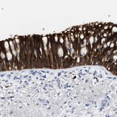 Anti-ALOX15 antibody produced in rabbit Prestige Antibodies&#174; Powered by Atlas Antibodies, affinity isolated antibody, buffered aqueous glycerol solution