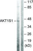 Anti-AKT1 S1 antibody produced in rabbit affinity isolated antibody