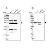 Anti-GRSF1 antibody produced in rabbit Prestige Antibodies&#174; Powered by Atlas Antibodies, affinity isolated antibody, buffered aqueous glycerol solution