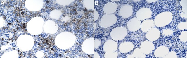 Anti-Lysozyme C Antibody, clone 1K16 ZooMAb&#174; Rabbit Monoclonal recombinant, expressed in HEK 293 cells