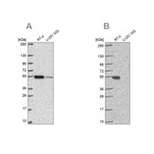 Anti-GSS antibody produced in rabbit Prestige Antibodies&#174; Powered by Atlas Antibodies, affinity isolated antibody, buffered aqueous glycerol solution