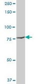 Anti-POR antibody produced in mouse purified immunoglobulin, buffered aqueous solution