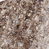 Anti-ALPL antibody produced in rabbit Ab1, Prestige Antibodies&#174; Powered by Atlas Antibodies, affinity isolated antibody, buffered aqueous glycerol solution