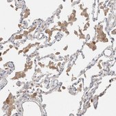 Anti-PROS1 antibody produced in rabbit Prestige Antibodies&#174; Powered by Atlas Antibodies, affinity isolated antibody, buffered aqueous glycerol solution