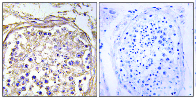 Anti-CHST9, C-Terminal antibody produced in rabbit affinity isolated antibody