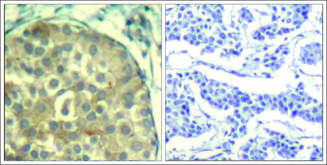 Anti-phospho-CFL1/CFL2 (pTyr88) antibody produced in rabbit affinity isolated antibody