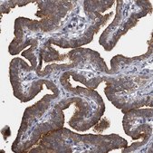 Anti-PRKCI antibody produced in rabbit affinity isolated antibody, buffered aqueous glycerol solution