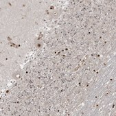 Anti-RBM10 antibody produced in rabbit Prestige Antibodies&#174; Powered by Atlas Antibodies, affinity isolated antibody, buffered aqueous glycerol solution