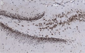 Anti-AFF2 Antibody, clone 1G13 ZooMAb&#174; Rabbit Monoclonal recombinant, expressed in HEK 293 cells