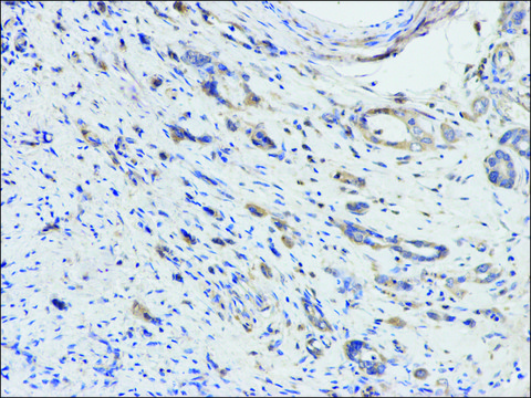 Anti-DPYD antibody produced in rabbit affinity isolated antibody