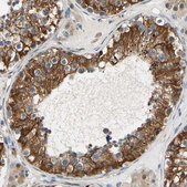 Anti-SLC27A6 antibody produced in rabbit Prestige Antibodies&#174; Powered by Atlas Antibodies, affinity isolated antibody, buffered aqueous glycerol solution