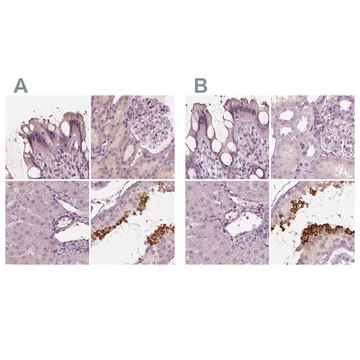 Anti-CALR3 antibody produced in rabbit Prestige Antibodies&#174; Powered by Atlas Antibodies, affinity isolated antibody, buffered aqueous glycerol solution