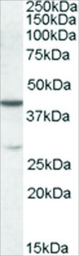 Anti-CBX8 antibody produced in goat affinity isolated antibody, buffered aqueous solution