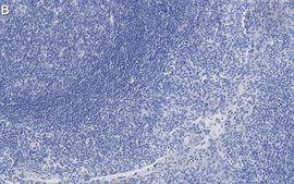 Anti-Clusterin Antibody, clone 2F23 ZooMAb&#174; Rabbit Monoclonal recombinant, expressed in HEK 293 cells