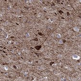 Anti-KCNH1 antibody produced in rabbit Prestige Antibodies&#174; Powered by Atlas Antibodies, affinity isolated antibody, buffered aqueous glycerol solution