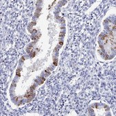 Anti-PDE4C antibody produced in rabbit Prestige Antibodies&#174; Powered by Atlas Antibodies, affinity isolated antibody, buffered aqueous glycerol solution