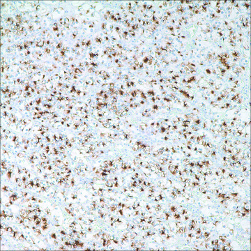 Renal Cell Carcinoma (PN-15) Mouse Monoclonal Antibody