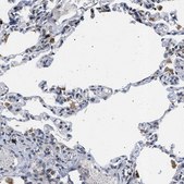 Anti-DERL1 antibody produced in rabbit Prestige Antibodies&#174; Powered by Atlas Antibodies, affinity isolated antibody, buffered aqueous glycerol solution