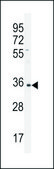 ANTI-IGHA1 (C-TERM) antibody produced in rabbit IgG fraction of antiserum, buffered aqueous solution
