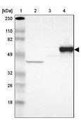 Anti-SERPINA7 antibody produced in rabbit Prestige Antibodies&#174; Powered by Atlas Antibodies, affinity isolated antibody, buffered aqueous glycerol solution