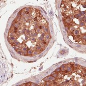 Monoclonal Anti-IDH1 antibody produced in mouse Prestige Antibodies&#174; Powered by Atlas Antibodies, clone CL0219, purified immunoglobulin, buffered aqueous glycerol solution
