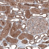 Anti-UMPS antibody produced in rabbit Prestige Antibodies&#174; Powered by Atlas Antibodies, affinity isolated antibody, buffered aqueous glycerol solution