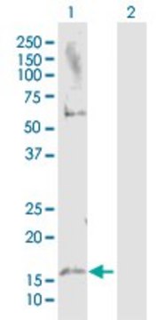Anti-MAP1LC3A antibody produced in rabbit purified immunoglobulin, buffered aqueous solution