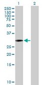 Anti-SCML1 antibody produced in mouse purified immunoglobulin, buffered aqueous solution