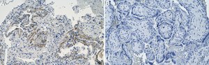 Anti-Laminin-5 Antibody, clone 1D3 ZooMAb&#174; Rabbit Monoclonal recombinant, expressed in HEK 293 cells