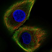 Anti-KRT17 antibody produced in rabbit Ab1, Prestige Antibodies&#174; Powered by Atlas Antibodies, affinity isolated antibody, buffered aqueous glycerol solution