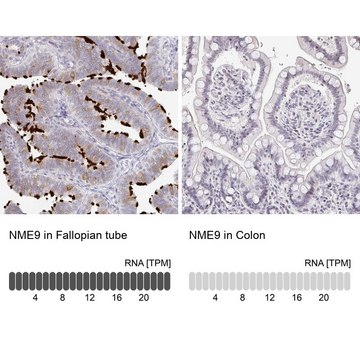 Anti-NME9 antibody produced in rabbit Prestige Antibodies&#174; Powered by Atlas Antibodies, affinity isolated antibody, buffered aqueous glycerol solution