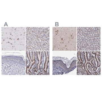 Anti-GOLIM4 antibody produced in rabbit Ab1, Prestige Antibodies&#174; Powered by Atlas Antibodies, affinity isolated antibody, buffered aqueous glycerol solution