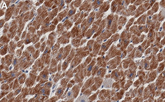 Anti-NDUFB8 Antibody, clone 1E7 ZooMAb&#174; Rabbit Monoclonal recombinant, expressed in HEK 293 cells