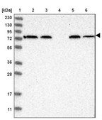 Anti-AFP antibody produced in rabbit Prestige Antibodies&#174; Powered by Atlas Antibodies, affinity isolated antibody, buffered aqueous glycerol solution