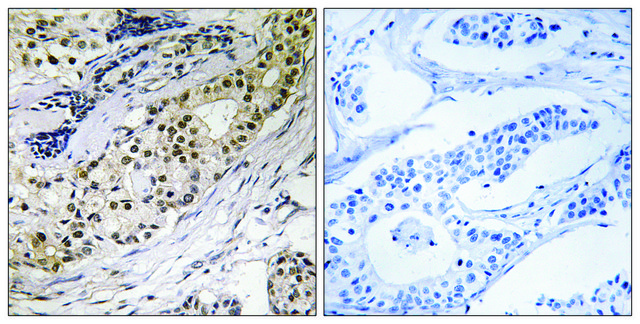 Anti-LAMA3 antibody produced in rabbit affinity isolated antibody