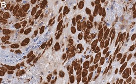 Anti-Transglutaminase 2 Antibody, clone 1G20 ZooMAb&#174; Rabbit recombinant, expressed in HEK 293 cells