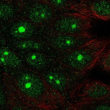 Anti-DLG3 antibody produced in rabbit Prestige Antibodies&#174; Powered by Atlas Antibodies, affinity isolated antibody