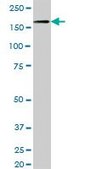 Anti-NID1 antibody produced in mouse IgG fraction of antiserum, buffered aqueous solution
