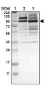Anti-ZKSCAN5 antibody produced in rabbit Prestige Antibodies&#174; Powered by Atlas Antibodies, affinity isolated antibody, buffered aqueous glycerol solution