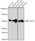 Anti-&#946;III-Tubulin Antibody, clone 6X6H6, Rabbit Monoclonal